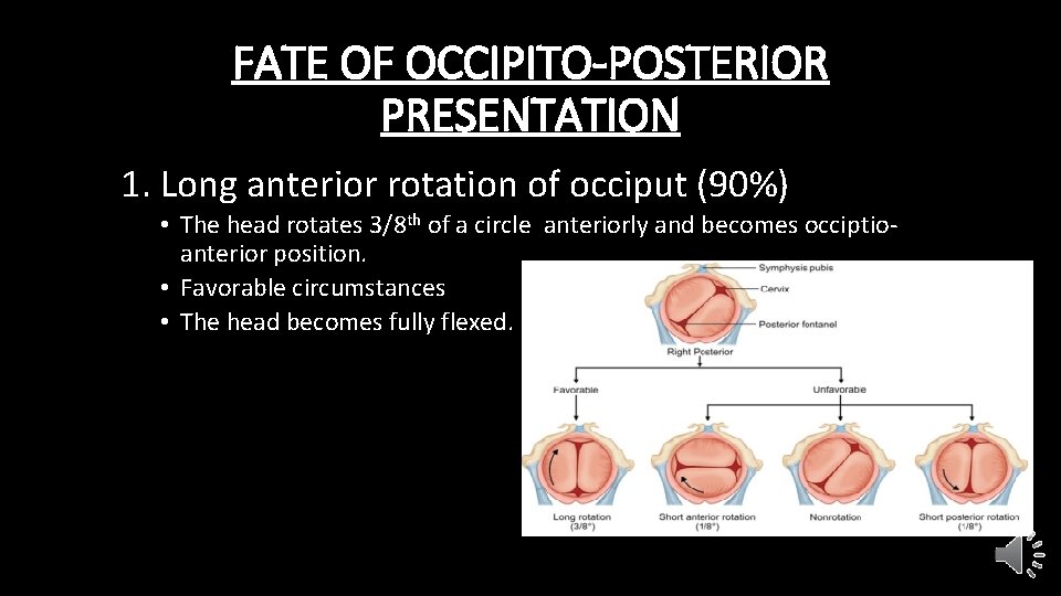 FATE OF OCCIPITO-POSTERIOR PRESENTATION 1. Long anterior rotation of occiput (90%) • The head