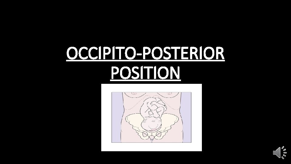 OCCIPITO-POSTERIOR POSITION 