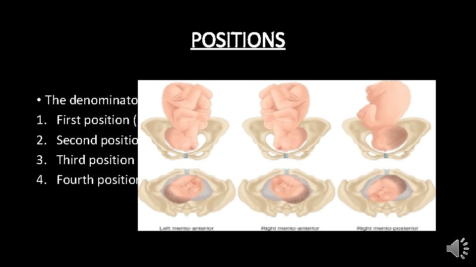 POSITIONS • The denominator is the chin (mentum) 1. First position (right mento-posterior) 2.