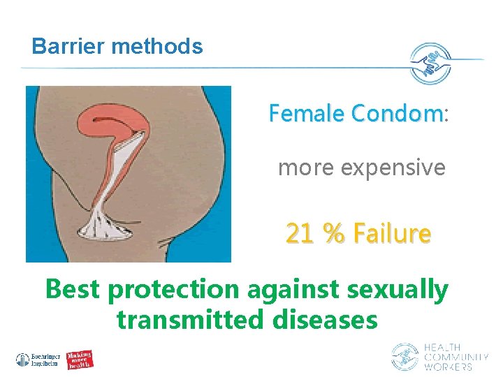 Barrier methods Female Condom: Female Condom more expensive 21 % Failure Best protection against