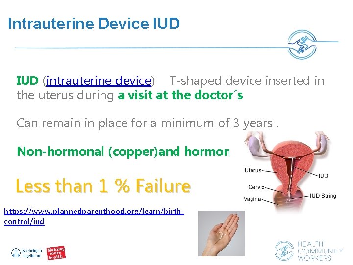 Intrauterine Device IUD (intrauterine device) T-shaped device inserted in the uterus during a visit