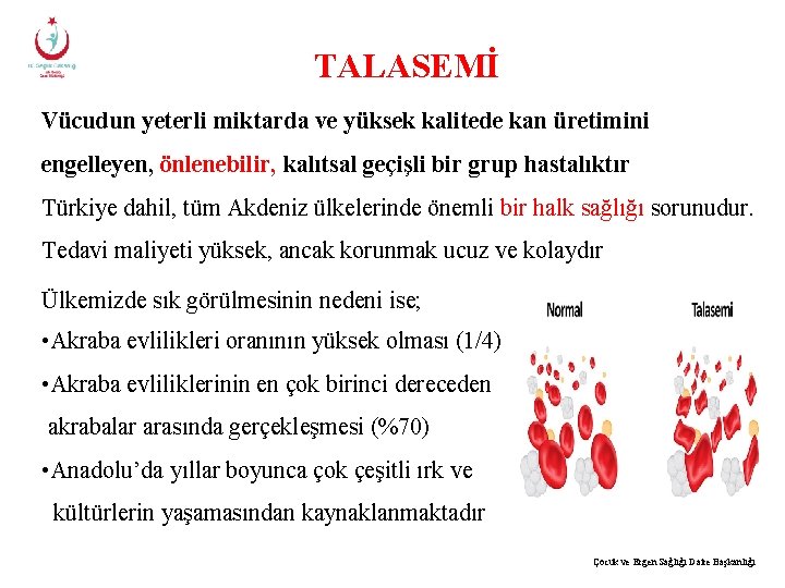 TALASEMİ Vücudun yeterli miktarda ve yüksek kalitede kan üretimini engelleyen, önlenebilir, kalıtsal geçişli bir