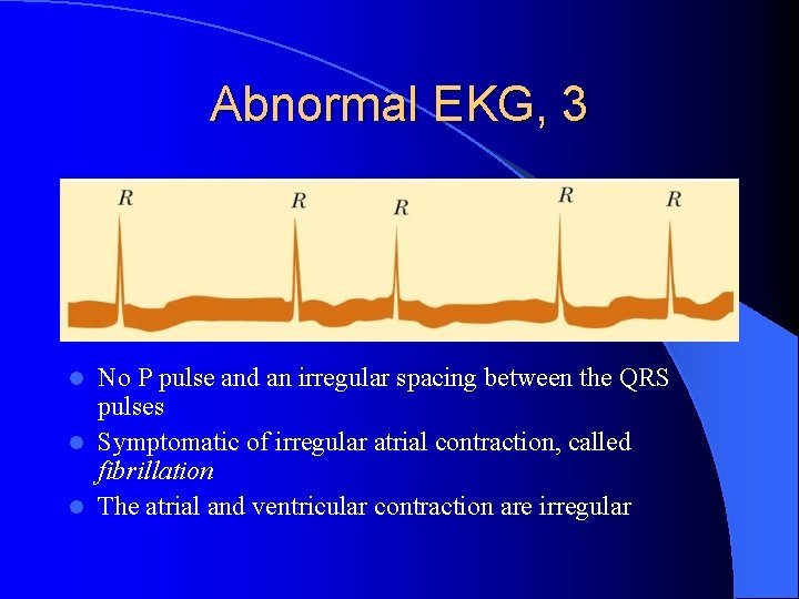 Abnormal EKG, 3 No P pulse and an irregular spacing between the QRS pulses