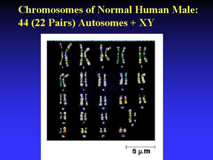Chromosomes of Normal Human Male: 44 (22 Pairs) Autosomes + XY 