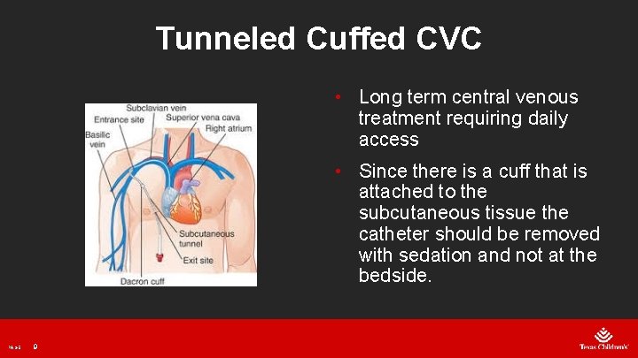 Tunneled Cuffed CVC • Long term central venous treatment requiring daily access • Since