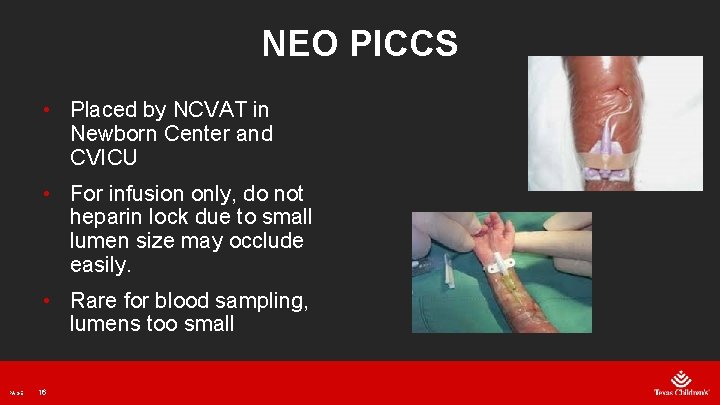 NEO PICCS • Placed by NCVAT in Newborn Center and CVICU • For infusion