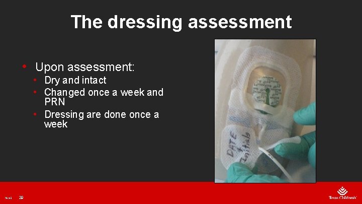 The dressing assessment • Upon assessment: • Dry and intact • Changed once a