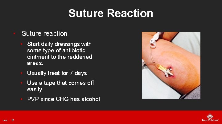 Suture Reaction • Suture reaction • Start daily dressings with some type of antibiotic