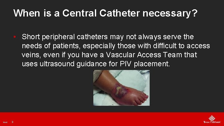 When is a Central Catheter necessary? • Short peripheral catheters may not always serve