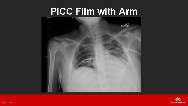 PICC Film with Arm PAGE 44 