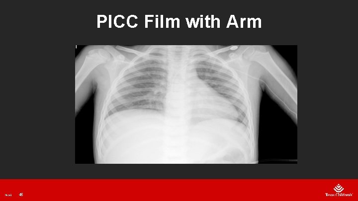 PICC Film with Arm PAGE 45 