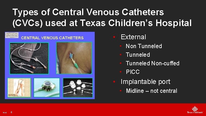 Types of Central Venous Catheters (CVCs) used at Texas Children’s Hospital • External •