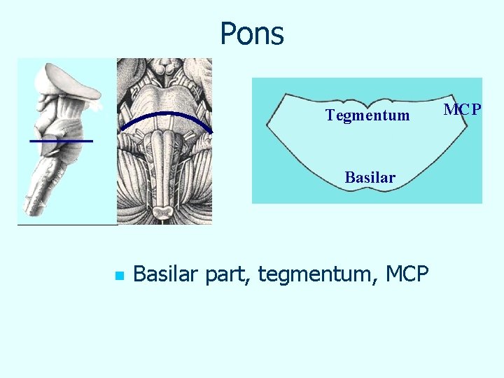 Pons Tegmentum Basilar n Basilar part, tegmentum, MCP 