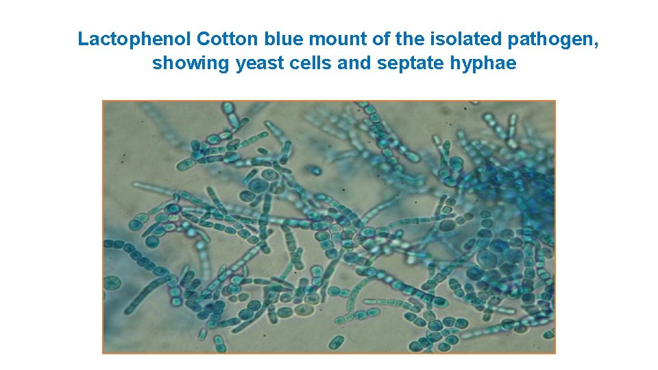  Lactophenol Cotton blue mount of the isolated pathogen, showing yeast cells and septate