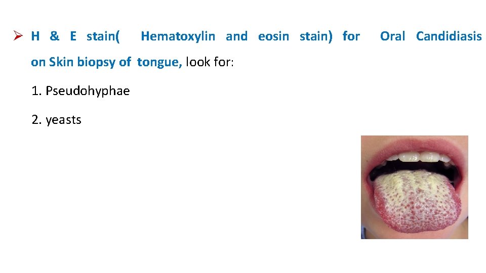  H & E stain( Hematoxylin and eosin stain) for on Skin biopsy of