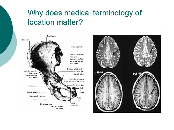 Why does medical terminology of location matter? Why does medical terminology of location matter?