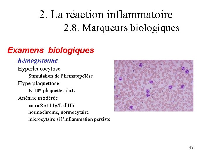 2. La réaction inflammatoire 2. 8. Marqueurs biologiques Examens biologiques hémogramme Hyperleucocytose Stimulation de 2. La réaction inflammatoire 2. 8. Marqueurs biologiques Examens biologiques hémogramme Hyperleucocytose Stimulation de