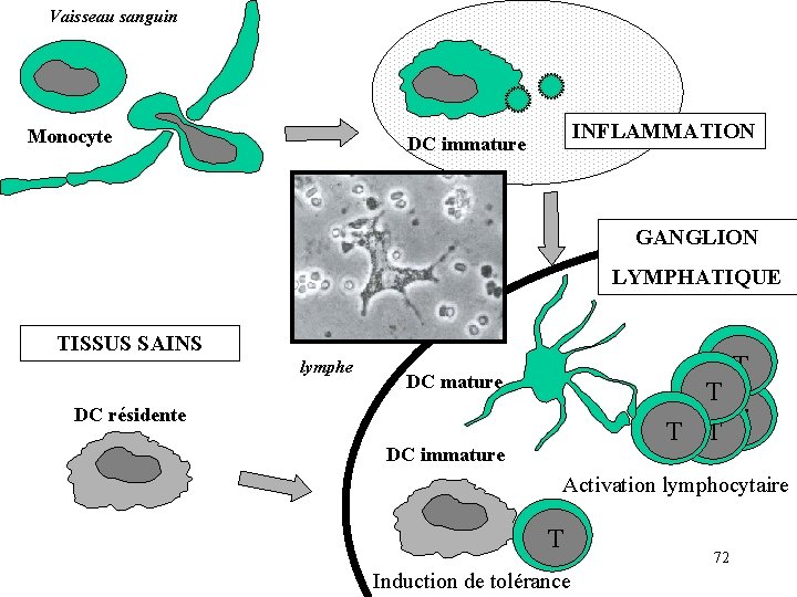Vaisseau sanguin Monocyte INFLAMMATION DC immature GANGLION LYMPHATIQUE TISSUS SAINS lymphe T DC mature Vaisseau sanguin Monocyte INFLAMMATION DC immature GANGLION LYMPHATIQUE TISSUS SAINS lymphe T DC mature