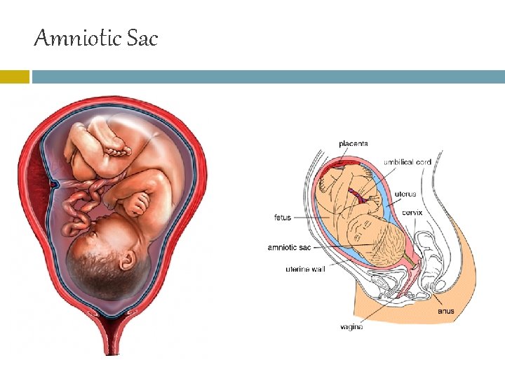 Amniotic Sac 
