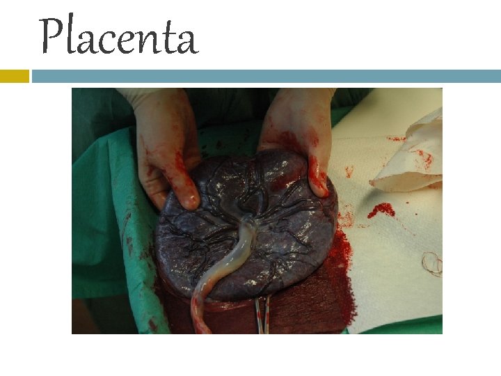 Placenta 