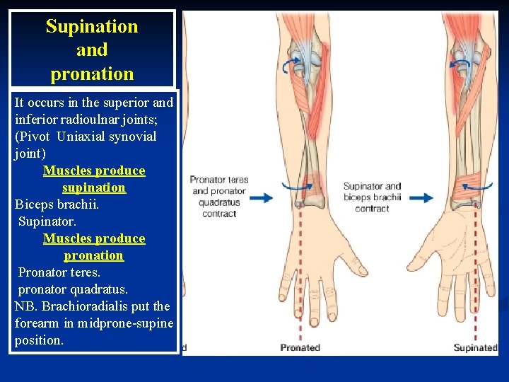 Supination and pronation It occurs in the superior and inferior radioulnar joints; (Pivot Uniaxial Supination and pronation It occurs in the superior and inferior radioulnar joints; (Pivot Uniaxial