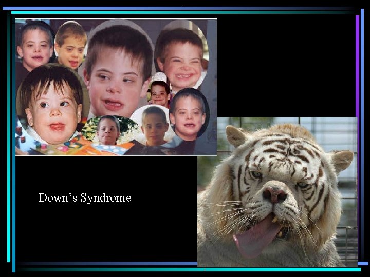 Down’s Syndrome 
