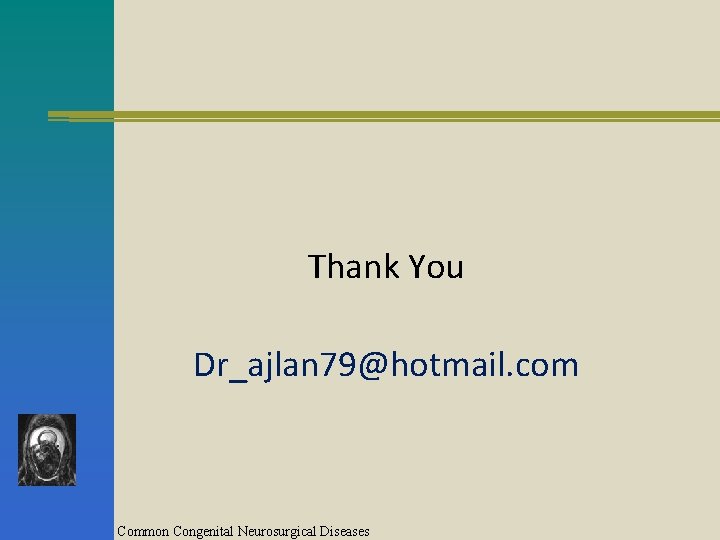 Thank You Dr_ajlan 79@hotmail. com Common Congenital Neurosurgical Diseases 