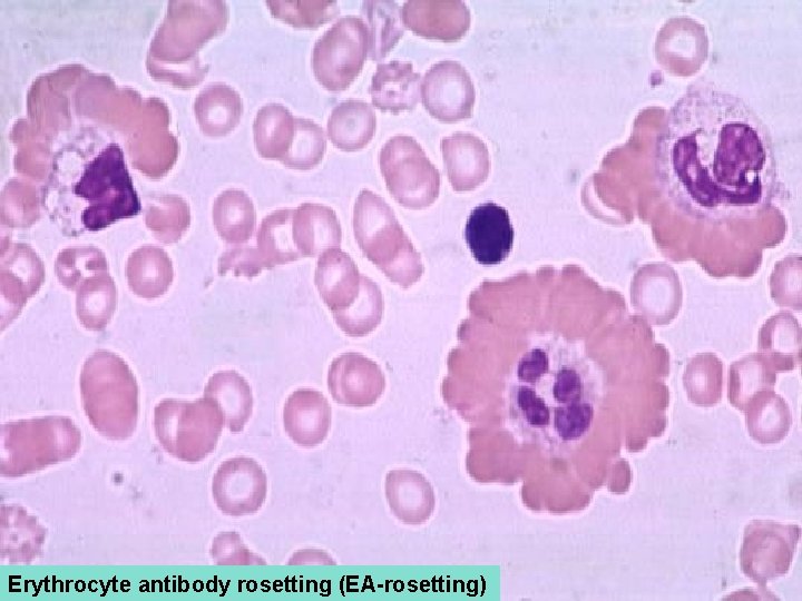 Erythrocyte antibody rosetting (EA-rosetting) 