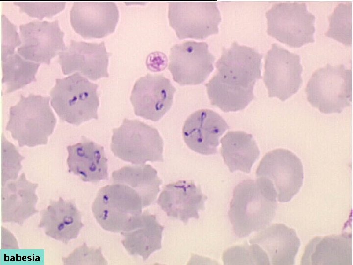 babesia 