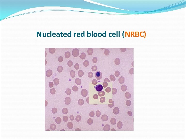 Nucleated red blood cell (NRBC) 