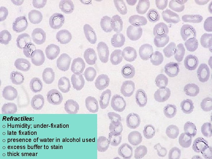 Refractiles: o Humidity; under-fixation o late fixation o presence of water in alcohol used