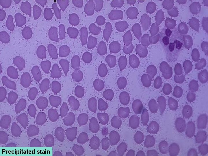 Precipitated stain 