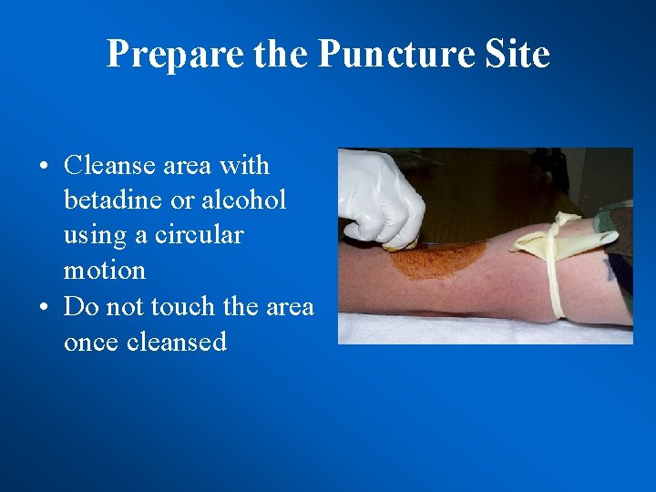 Prepare the Puncture Site • Cleanse area with betadine or alcohol using a circular