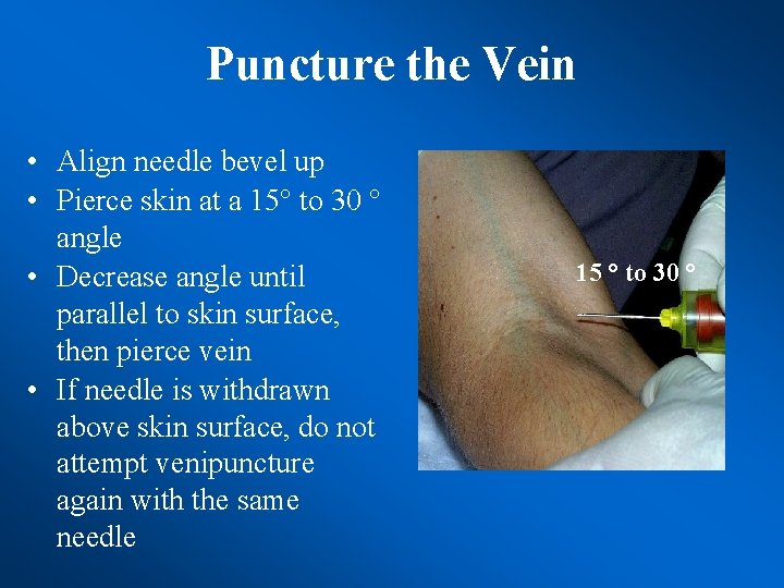 Puncture the Vein • Align needle bevel up • Pierce skin at a 15°
