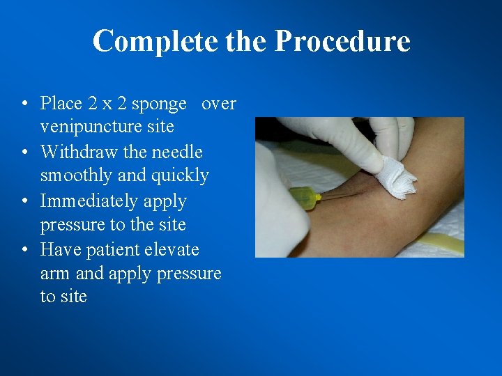 Complete the Procedure • Place 2 x 2 sponge over venipuncture site • Withdraw