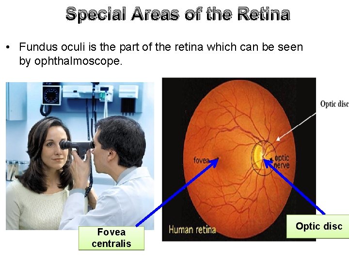 Special Areas of the Retina • Fundus oculi is the part of the retina