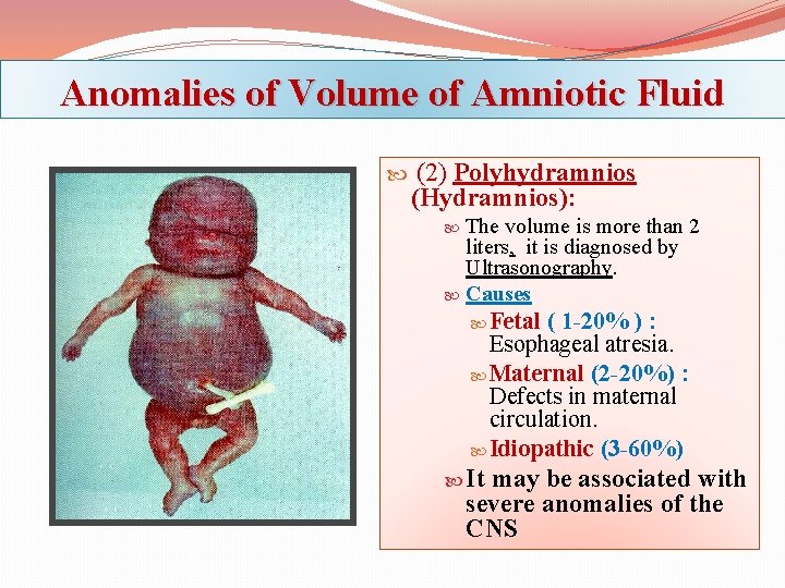Anomalies of Volume of Amniotic Fluid (2) Polyhydramnios (Hydramnios): The volume is more than
