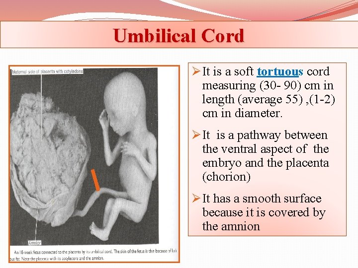 Umbilical Cord Ø It is a soft tortuous cord measuring (30 - 90) cm