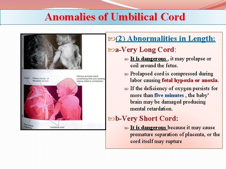 Anomalies of Umbilical Cord (2) Abnormalities in Length: a-Very Long Cord: It is dangerous