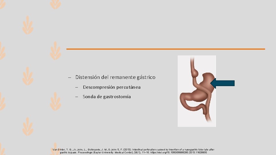 – Distensión del remanente gástrico – Descompresión percutánea – Sonda de gastrostomía Van Dinter,