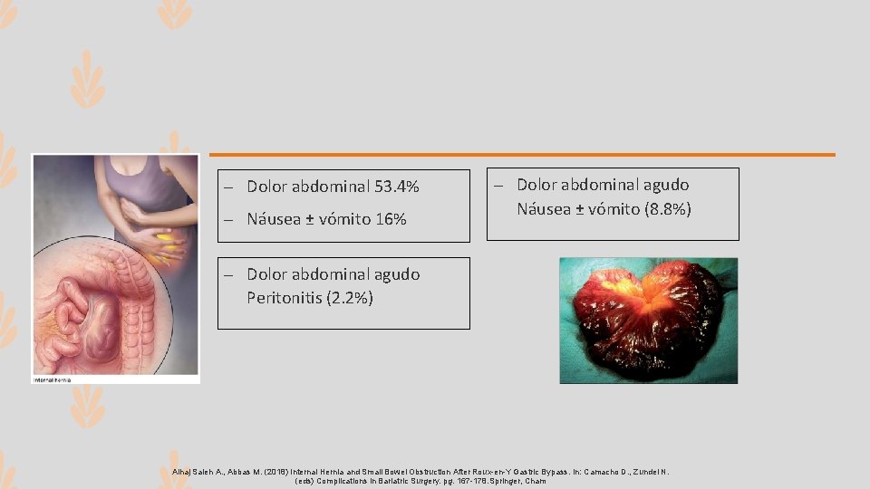 – Dolor abdominal 53. 4% – Náusea ± vómito 16% – Dolor abdominal agudo