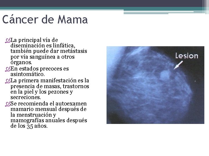 Cáncer de Mama La principal vía de diseminación es linfática, también puede dar metástasis