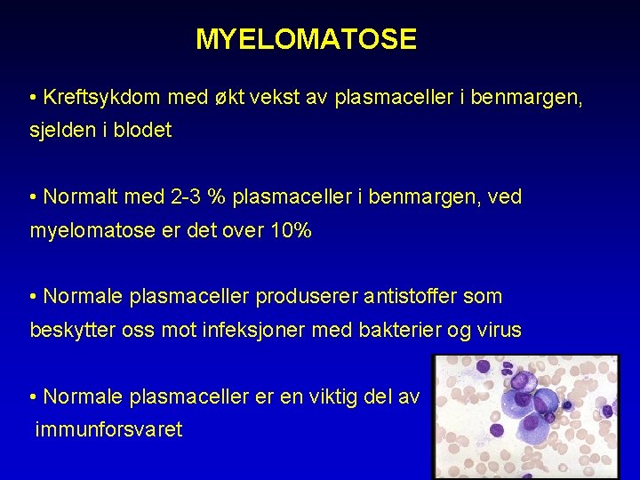 MYELOMATOSE • Kreftsykdom med økt vekst av plasmaceller i benmargen, sjelden i blodet •