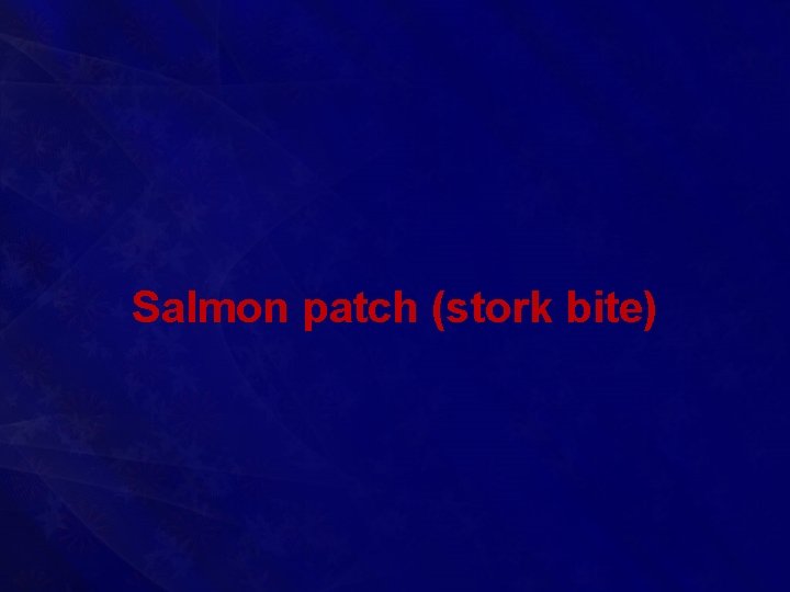 Salmon patch (stork bite) 