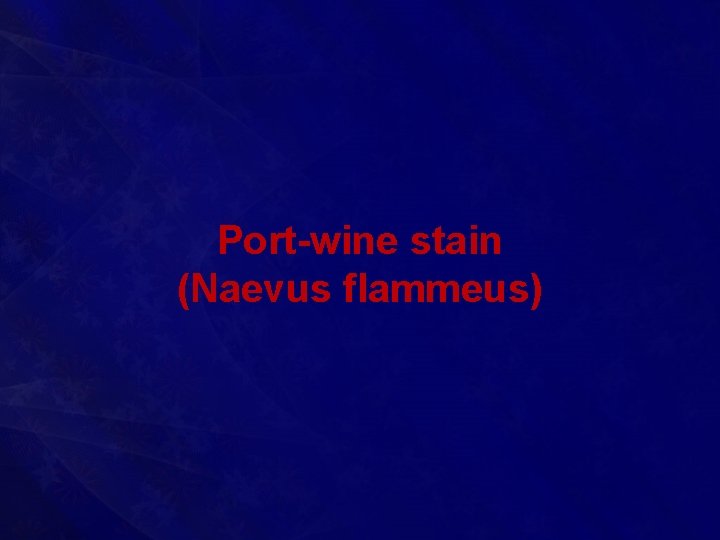 Port-wine stain (Naevus flammeus) 