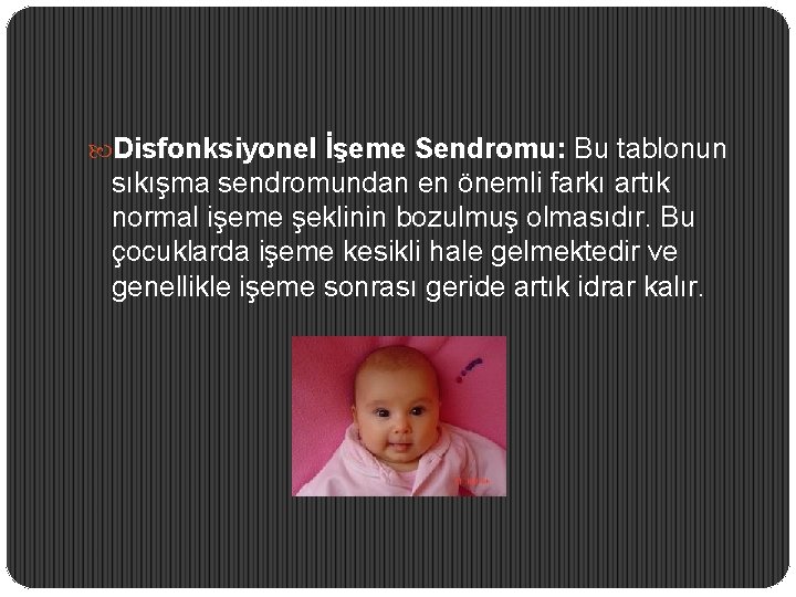  Disfonksiyonel İşeme Sendromu: Bu tablonun sıkışma sendromundan en önemli farkı artık normal işeme