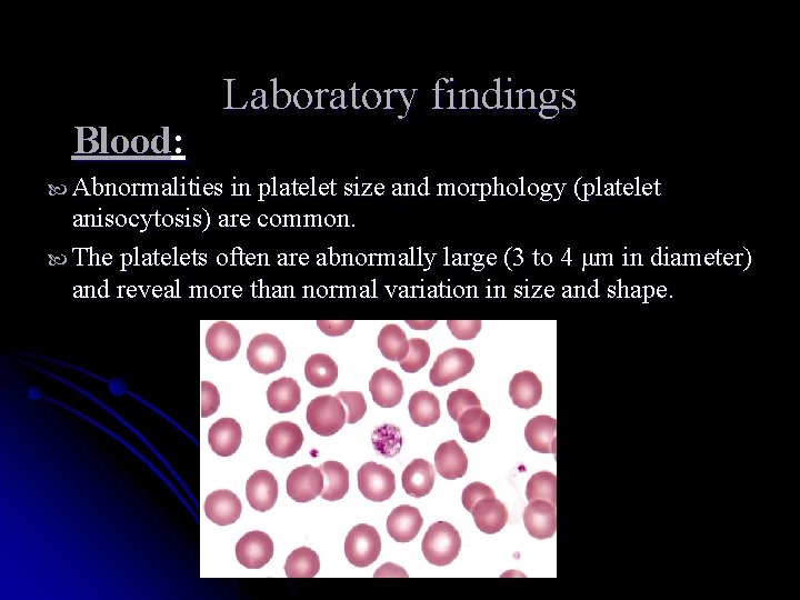 Blood: Laboratory findings Abnormalities in platelet size and morphology (platelet anisocytosis) are common. The