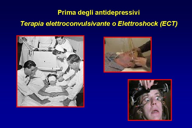 Prima degli antidepressivi Terapia elettroconvulsivante o Elettroshock (ECT) 
