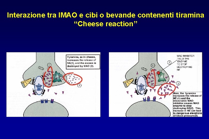 Interazione tra IMAO e cibi o bevande contenenti tiramina “Cheese reaction” 