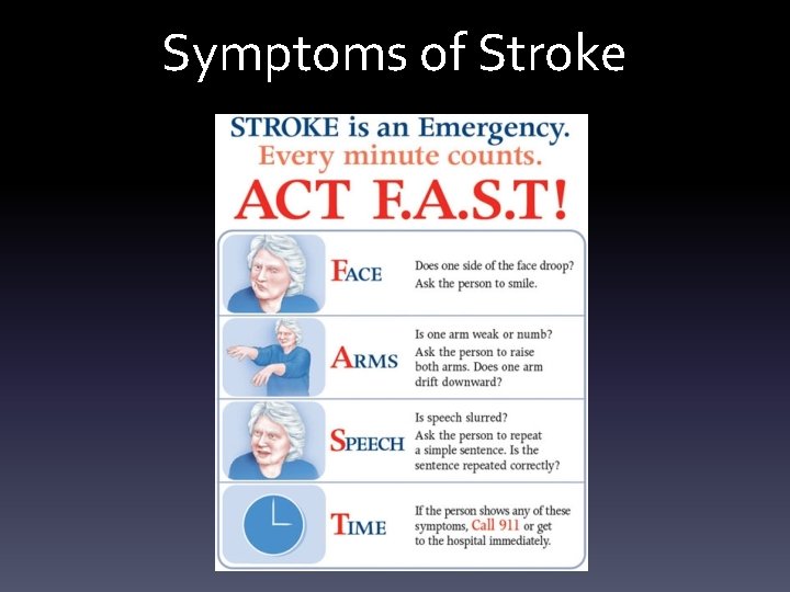 Symptoms of Stroke 